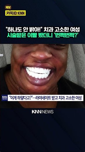 "Should have made them whiter": Dissatisfied with procedure, patient even sues dentist? What happ...