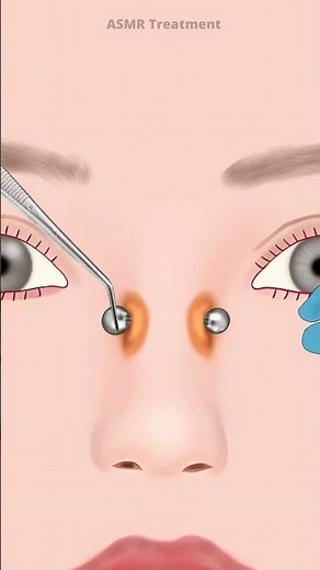 ASMR Nostril Piercing Treatment Animation
