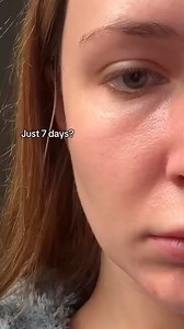 580K views · 985 reactions | ️ Key Features of Seoul 1988 Eye Cream...