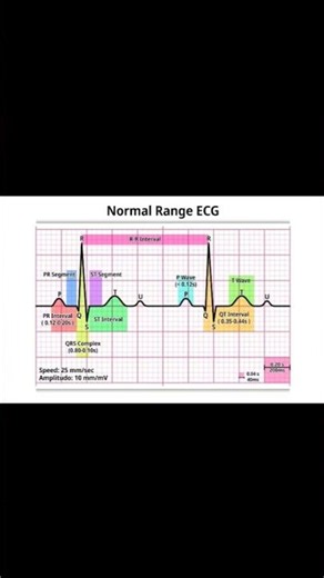 ECG Normal Range