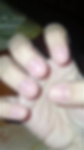 DAY 5✅️ sorry guys I got too tired to film day 4 yesterday🥹#nailgrowthjourney #nailbiter #girlies #nailgrowth #shortnails