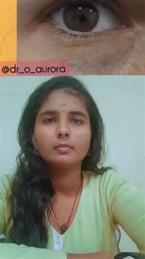 👁️ Ever feel your eye “jumping”? 👁️ Have you ever experienced that involuntary flutter in your eyelid? In the medical world, we call this Myokymia😵‍💫 (Eyelid Muscle Twitching)💯🍃 ✅While it’s usually harmless and temporary, your body might be trying to tell you something! 🛑 📢 Share this with a friend who spends too much time on their phone! ⚠️Follow @dr_o_aurora for more expert health tips! 🌿Call us-9944505991🤙 #EyeTwitch #Myokymia #HealthTips #SiddhaMedicine #EyeCare Wellness# DrOviya |