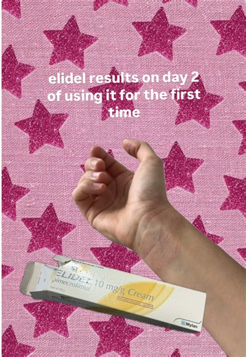 Elidel Cream: Day 2 Check-In for Eczema Relief