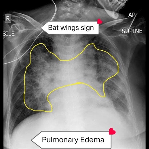 Top 10 Chest X-ray Cases Every Student Should Learn.