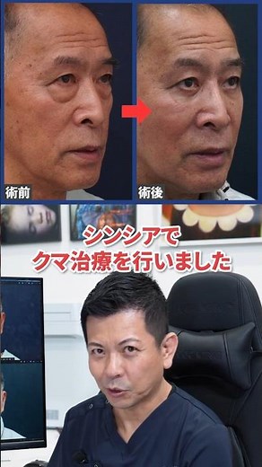 【若返り】クマ治療で78歳がここまで変わる！？