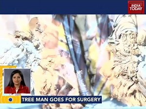 50 reactions · 43 shares | Bangladesh's tree man to remove warts through surgery. #ITVideo | India Today | Facebook