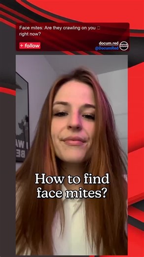 docum on Instagram: "This seemingly simple method of using clear tape to 'find face mites' actually demonstrates a common, though informal, technique for sampling these microscopic inhabitants. What you're seeing magnified is unmistakably *Demodex folliculorum*, a type of mite that lives in the hair follicles and sebaceous glands of human faces. Here's what they're not telling you: almost every adult human harbors these tiny arachnids, typically without any adverse effects. They're harmless scav