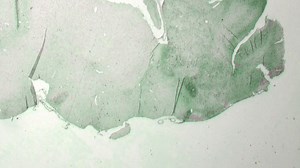 Access to brain health