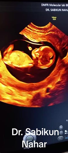 Understanding 11-Week Old Baby Development
