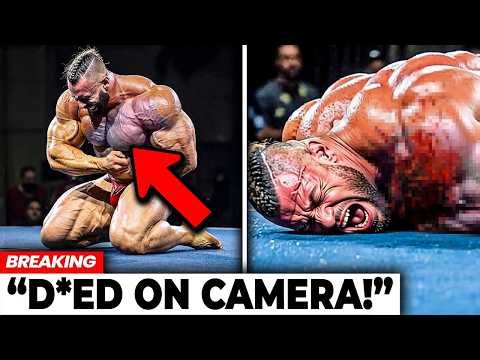 Bodybuilders Who Had Their Muscles Explode On Stage