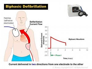 Waveform Visualization of a Biphasic Defibrillator