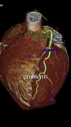 What’s the #1 killer in Australia? Heart disease. The good news? Most cases are preventable, if caught early. Everlab gives you a deep health assessment, testing for risks before symptoms appear. ✅ Screen for heart disease, cancer, and metabolic disorders ✅ Get a personalised prevention plan ✅ Access Australia’s best longevity doctors Take control of your health. Book your test today. Take control of your health today! | Everlab