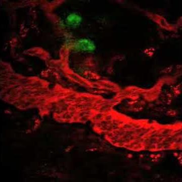 #NIDCR: Vascular Flow Close to a Lymph Node in a Live Mouse Harboring a Metastatic Tumor