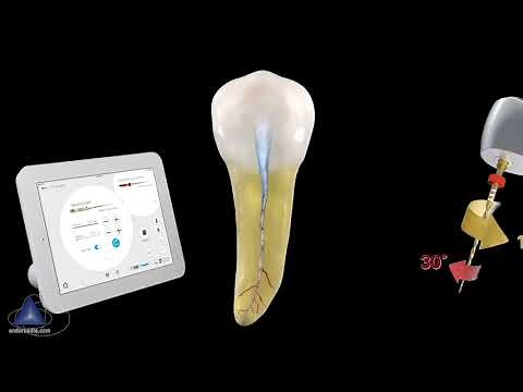 WaveOne® Gold Glider with Dr. Cliff Ruddle | Dentsply Sirona