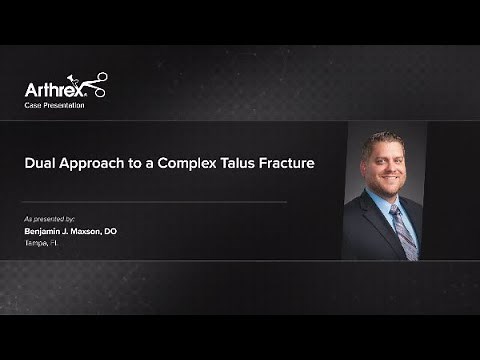 Dual Approach to a Complex Talus Fracture