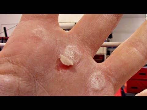 Gymnastics Rip Hacks! How To Care For The Rip On Your Hand With Coach Meggin!