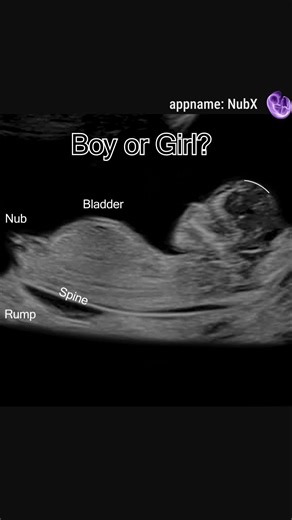 Exciting Gender Reveal: Is It a Baby Boy or Girl?