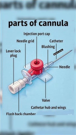 Parts of Iv cannula | Intracath | Bsc Nursing