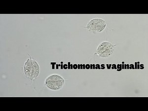 Trichomonas vaginalis in urine microscopy at 40X power | Trichomonas vaginalis motility