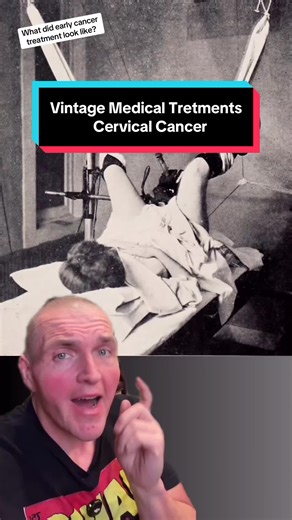 Historical Treatment of Cervical Cancer