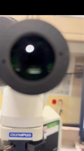 92K views · 1.2K reactions | Urine sample | Lab life | Facebook