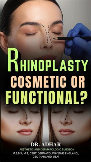 Rhinoplasty: Cosmetic or Functional? | Dr. Adhar Kashyap #rhinoplasty #shorts