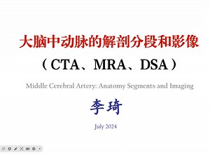 大脑中动脉分段和CTA MRA DSA影像 MCA