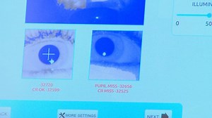 New eye tracking technology used to detect concussions