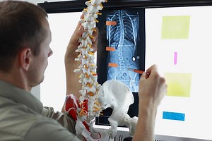 Skolioza - 10 jednostavnih vježbi za liječenje funkcionalnih skolioza | Fitness.com.hr