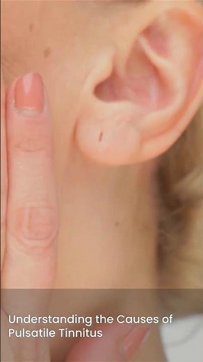 Why You Hear Your Heartbeat in Your Ear 😳 | RN Explains 123