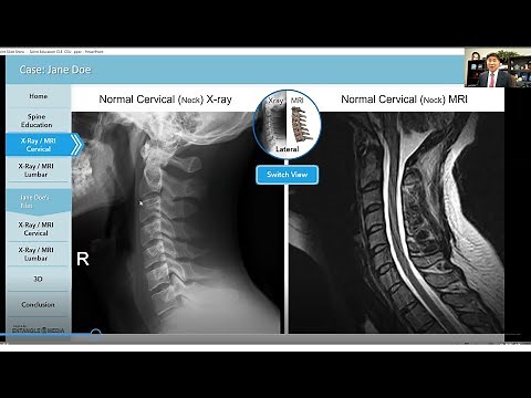 X Ray versus MRI of the Spine