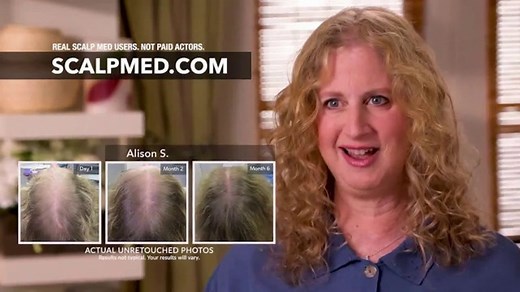 ScalpMED 15th Anniversary Celebration TV Spot, 'Are You Losing Your Hair?'