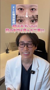 【目元フル整形】アイドル級の可愛さに！ドールアイ症例解説