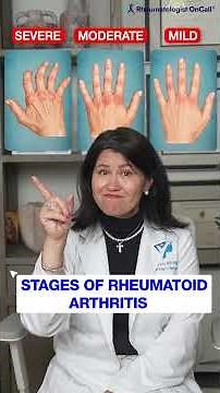 What Stage Is Your Rheumatoid Arthritis? A Rheumatologist Shows You