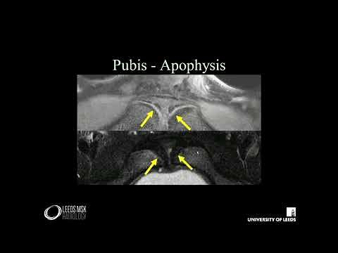 Imaging of the pelvis