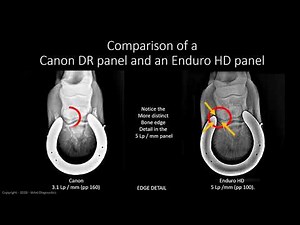 Image Quality in Digital Radiography