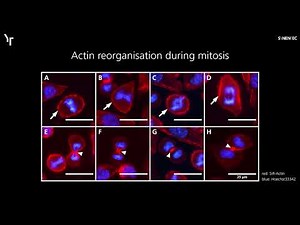 SYNENTEC - High-content Imaging of the Actin Cytoskeleton using SiR-Actin and CELLAVISTA®
