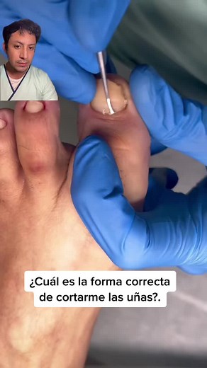 ¿Cómo cortar adecuadamente las uñas de los pies?