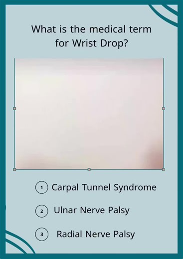 ‏Quick Question 🫣 #CapCut #medical #physiotherapy #اكسبلور #jordan