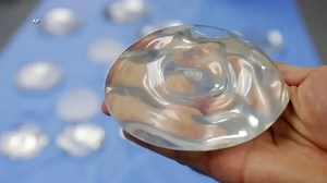 Potential risks of breast implants and what you need to know