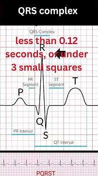 Normal ECG explanation