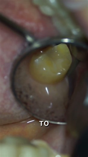 More reviews on my Telegram channel @stomatdent