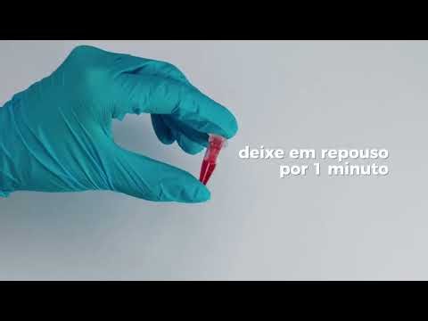 AFR 200 | Precisão e rapidez em diagnósticos laboratoriais
