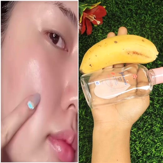 9.6K views · 185 reactions | Mix Banana Peel with Baby Oil ~ The secret that no one will tell you ~ Thank me later! | Cure Simple Remedy | Facebook
