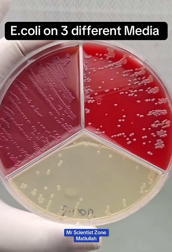 E. coli Colony Appearance on MacConkey, Blood & EMB Agar