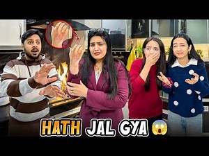 Dangerous Burning Prank On Areeb 😭 Ghar Walon Ka Reaction 😱