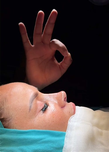 Understanding Rhinoplasty: Benefits and Recovery Tips