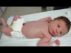 Newborn Baby Umbilical Cord Care | Oral Drops | Physiotherapy & Neonatal Care Guide