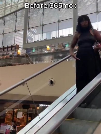 Facing My Past Self: A Liposuction Journey