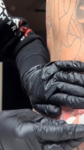 Enjoy Watching New Daily Pimples Everyday #pimplepop #satisfying | 𝐂𝐔𝐑𝐄 𝐀𝐍𝐈𝐌𝐀𝐓𝐈𝐎𝐍 𝐂𝐋𝐔𝐁